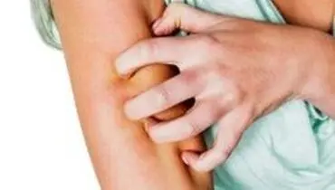 از پوست‌های خارش دار چه میدانید؟