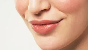 راهکار‌هایی برای از بین بردن خط خنده