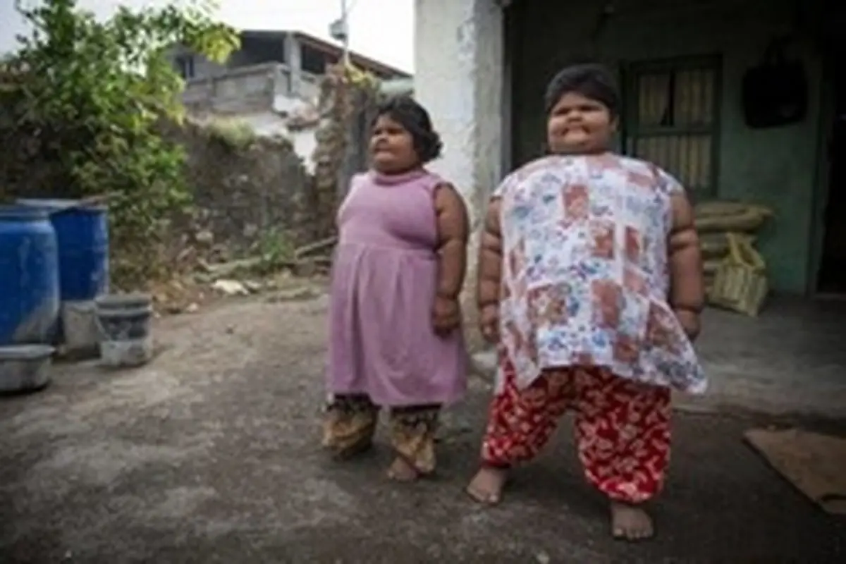 چاق‌ترین خواهران دنیا با گرسنگی وحشتناک!