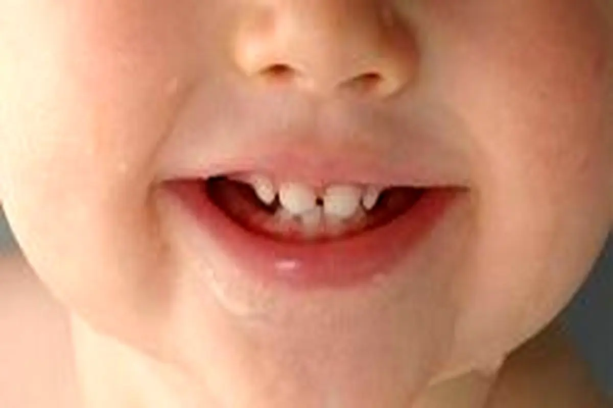 آیا استفراغ کردن نوزادان از علائم دندان درآوردن آنهاست؟