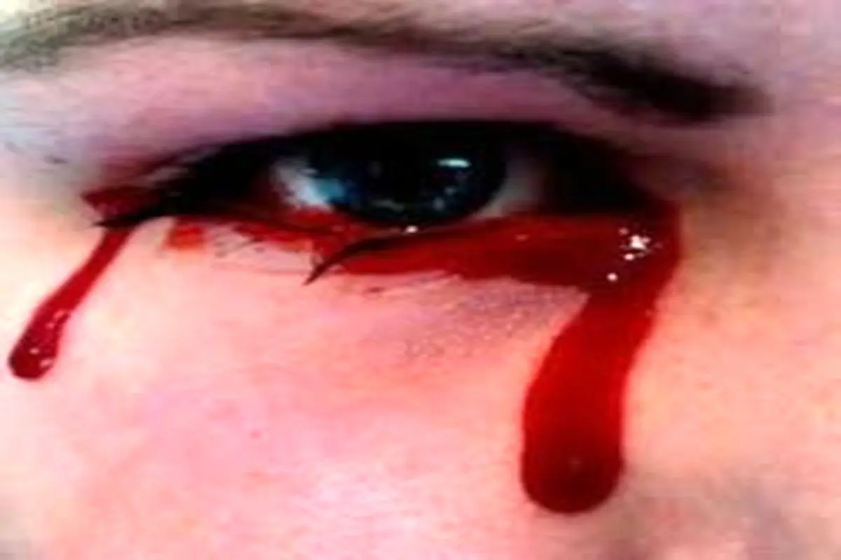 مردی که به جای اشک، خون گریه کرد!