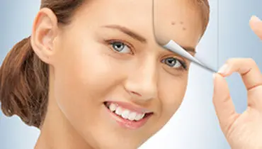 
از بین بردن جای جوش با این روغن