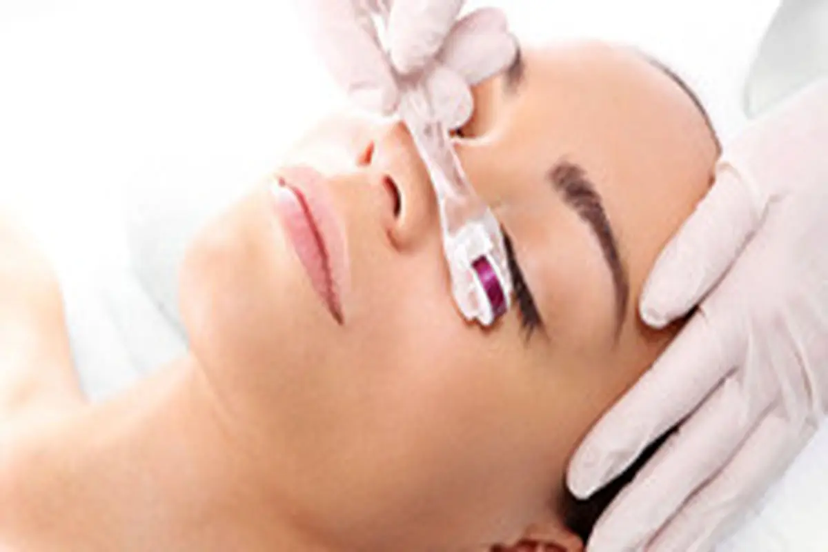 میکرونیدلینگ خانگی چه ویژگیهایی دارد و روش انجام آن چگونه است؟