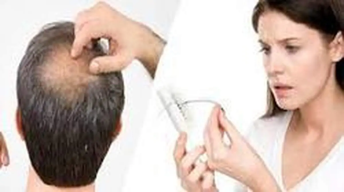 چاره نهایی ریزش مو چیست؟