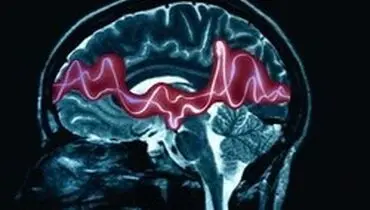 چند راهنمایی برای چگونگی برخورد با افراد مبتلا به صرع