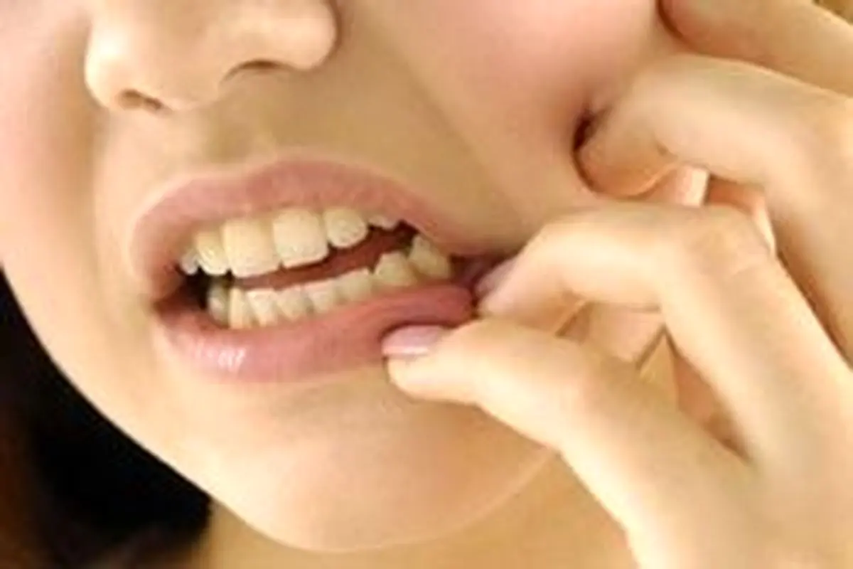 درمان فوری و سه سوته دندان درد با بهترین مسکن‌های خانگی
