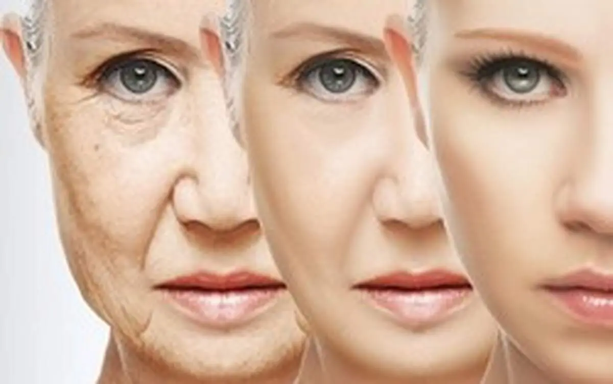 روشهایی برای از بین بردن چین و چروک صورت
