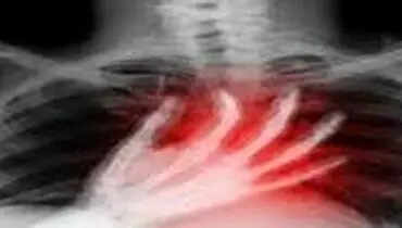 سندرم قلب شکسته چیست؟