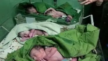 بانوی ترکمن در گلستان صاحب فرزندان ۴ قلو شد