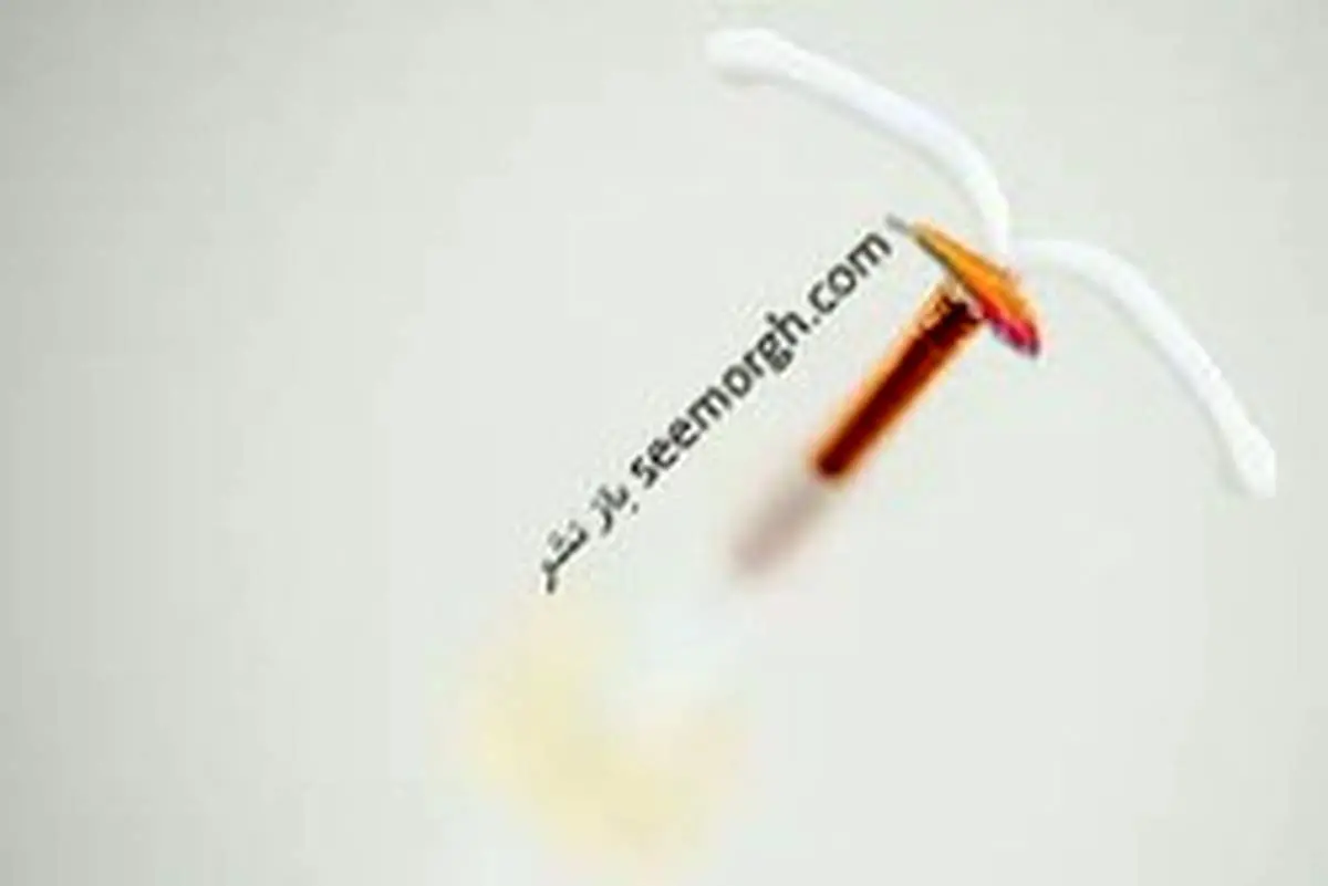 عوارض آی یودی IUD مسی برای پیشگیری از بارداری که هر زنی باید بدانند