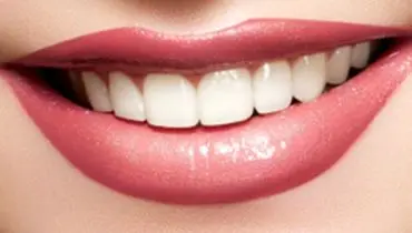 ترفند‌های ارزان برای سفید کردن دندان‌ها
