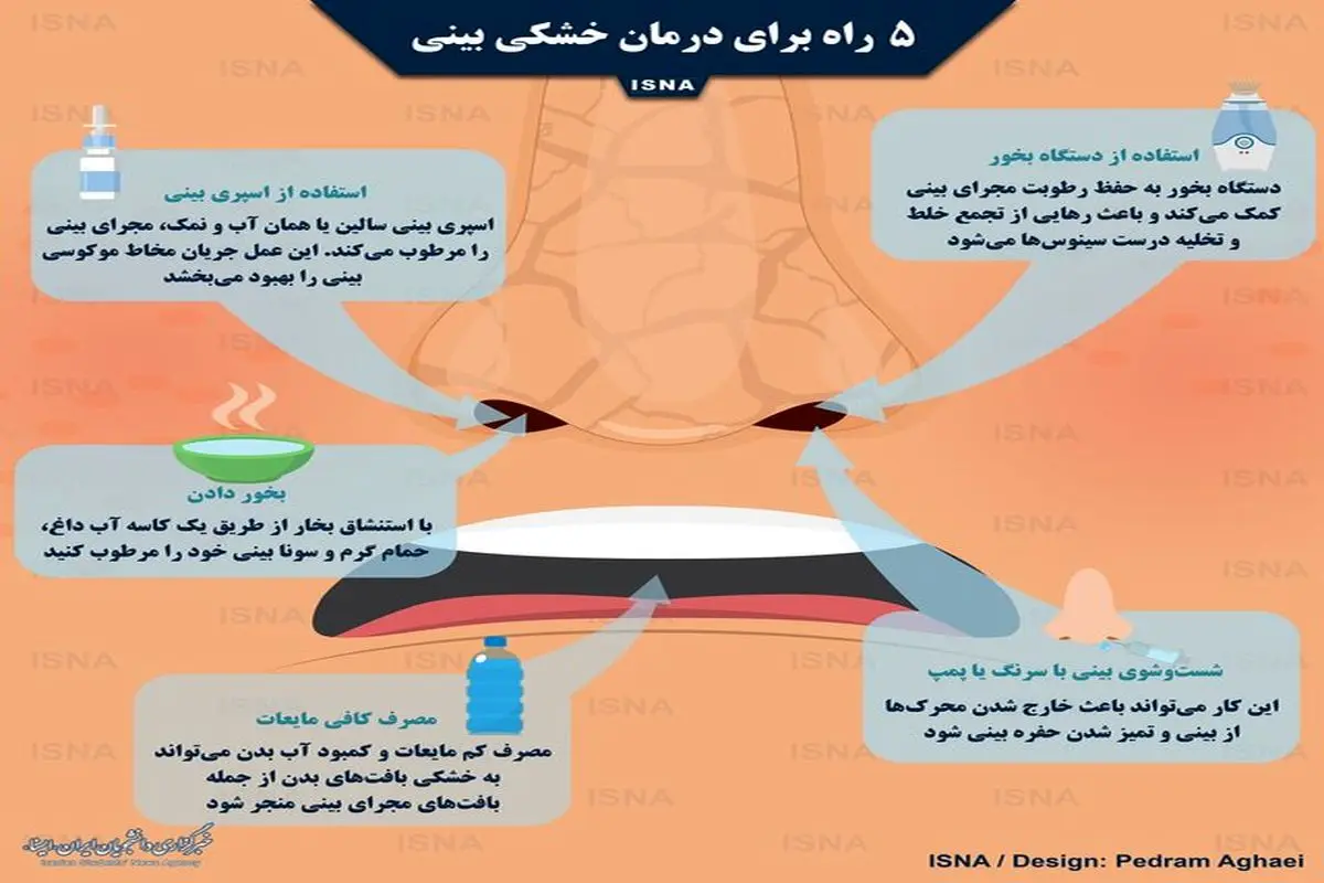 ۵ راه برای درمان خشکی بینی/ اینفوگرافی