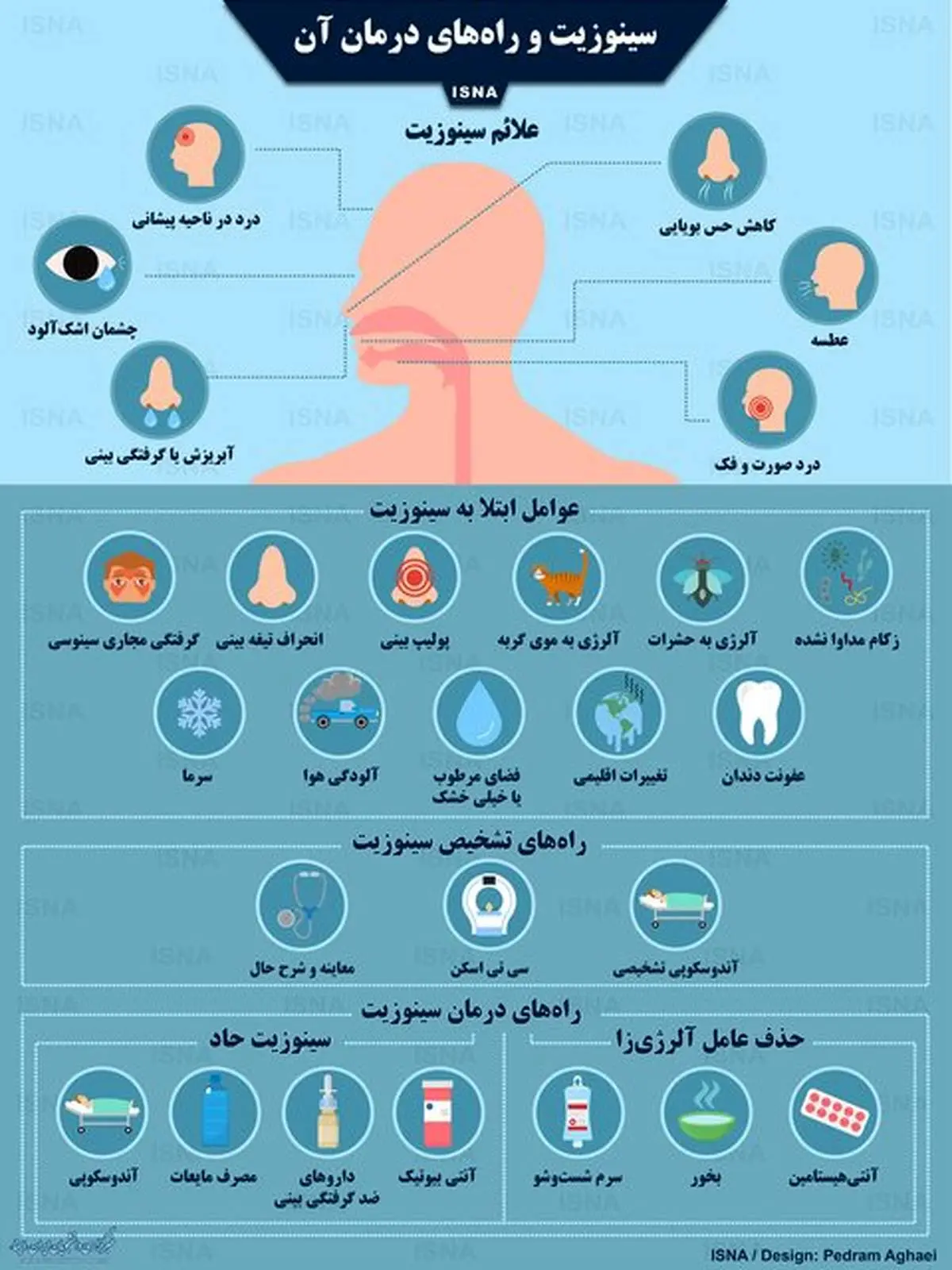 سینوزیت و راه‌های درمان آن/اینفوگرافی