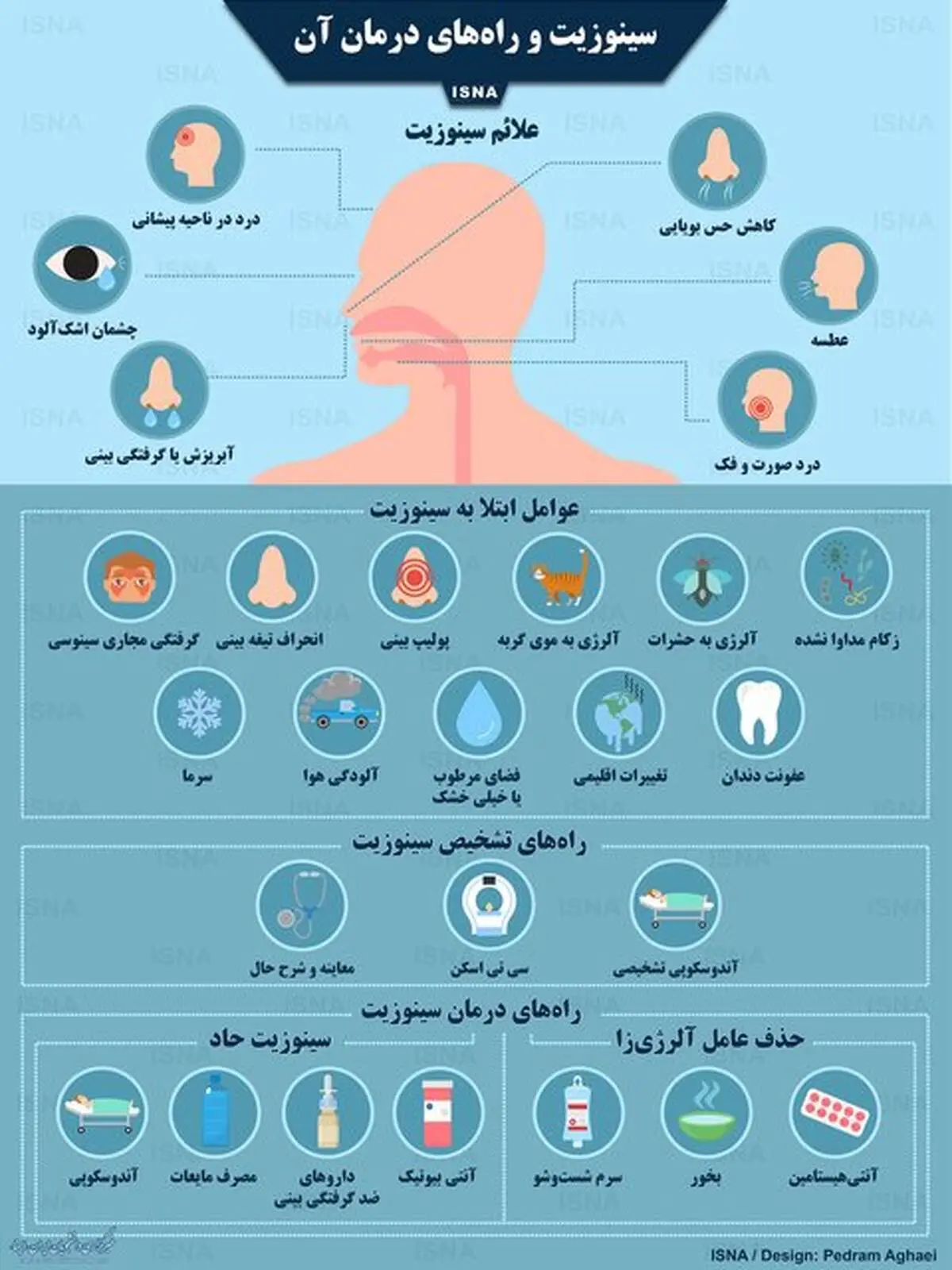 سینوزیت و راه‌های درمان آن/اینفوگرافی