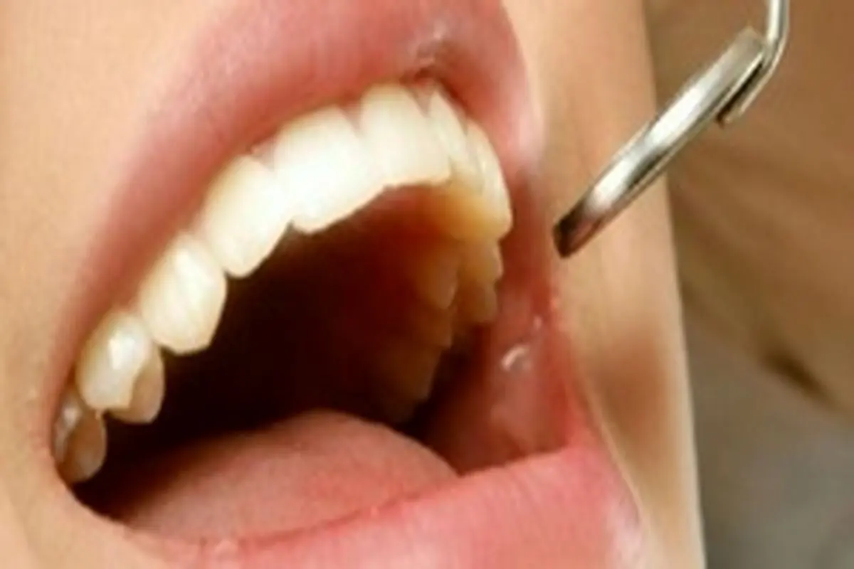 علت سیاه شدن دندان چیست؟