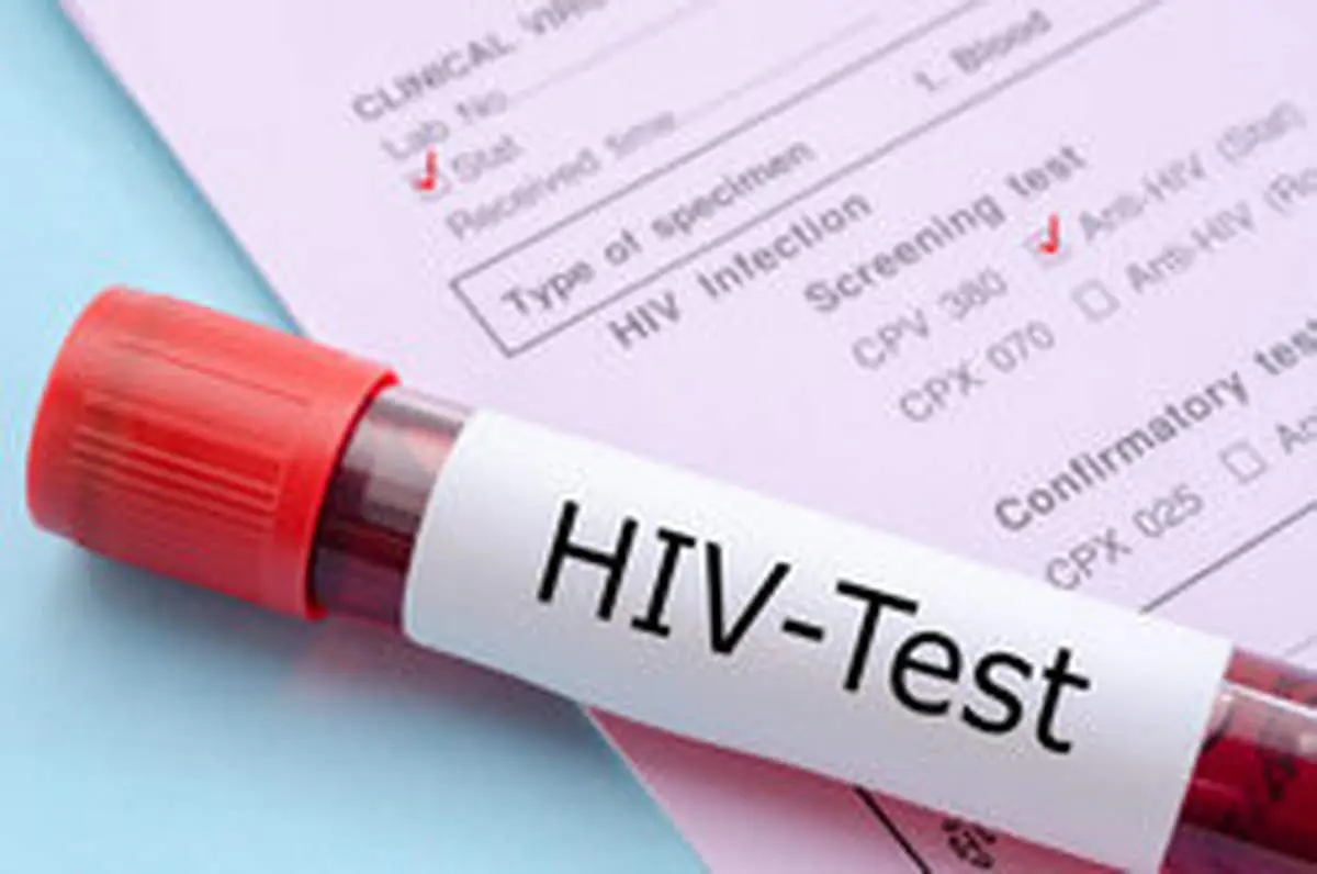علائم HIV در زنان