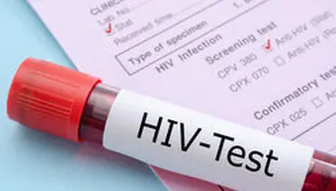 علائم HIV در زنان