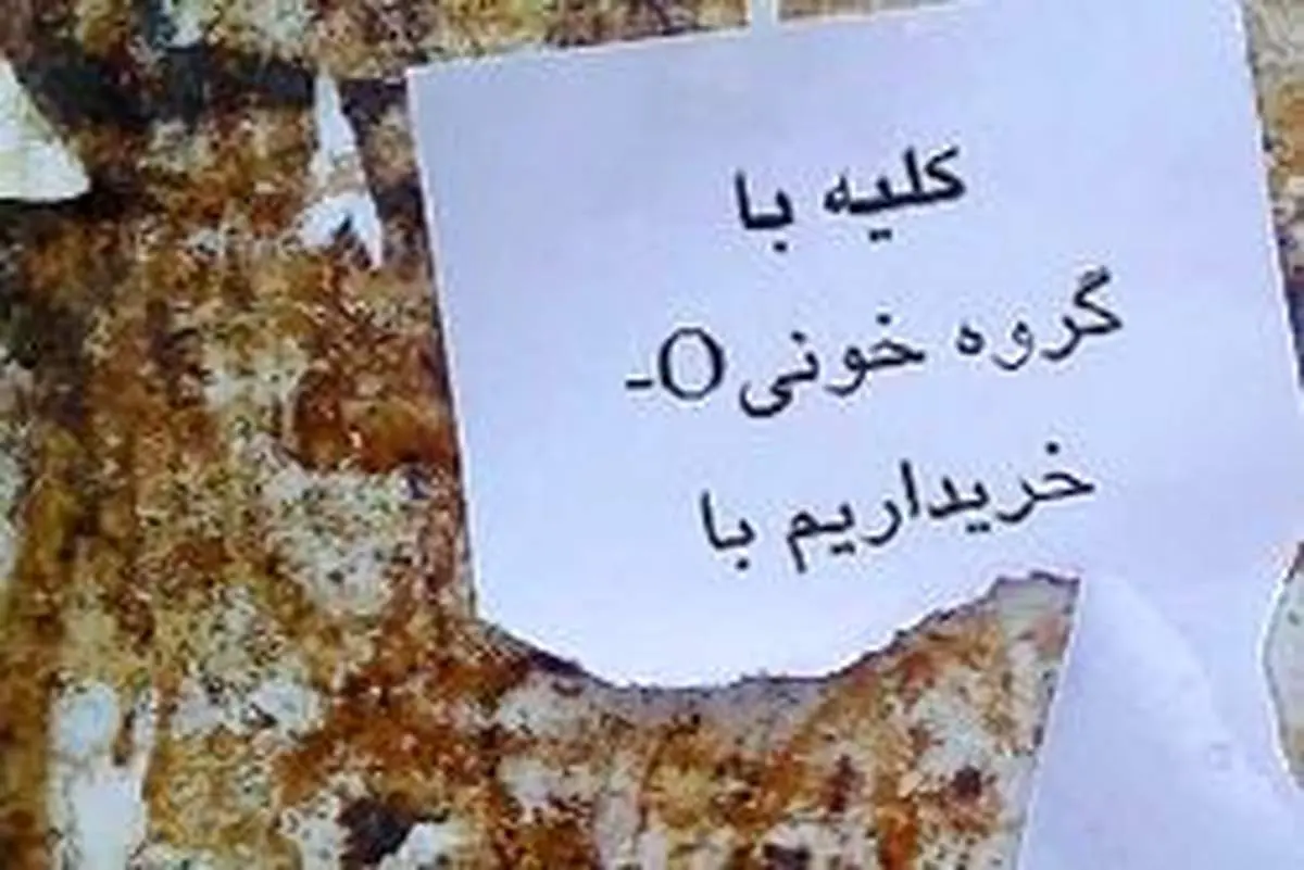 یک تکه کبد، ۱۵۰میلیون تومان!