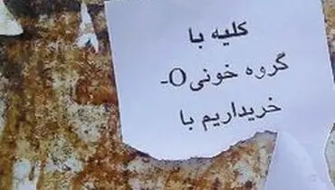 یک تکه کبد، ۱۵۰میلیون تومان!