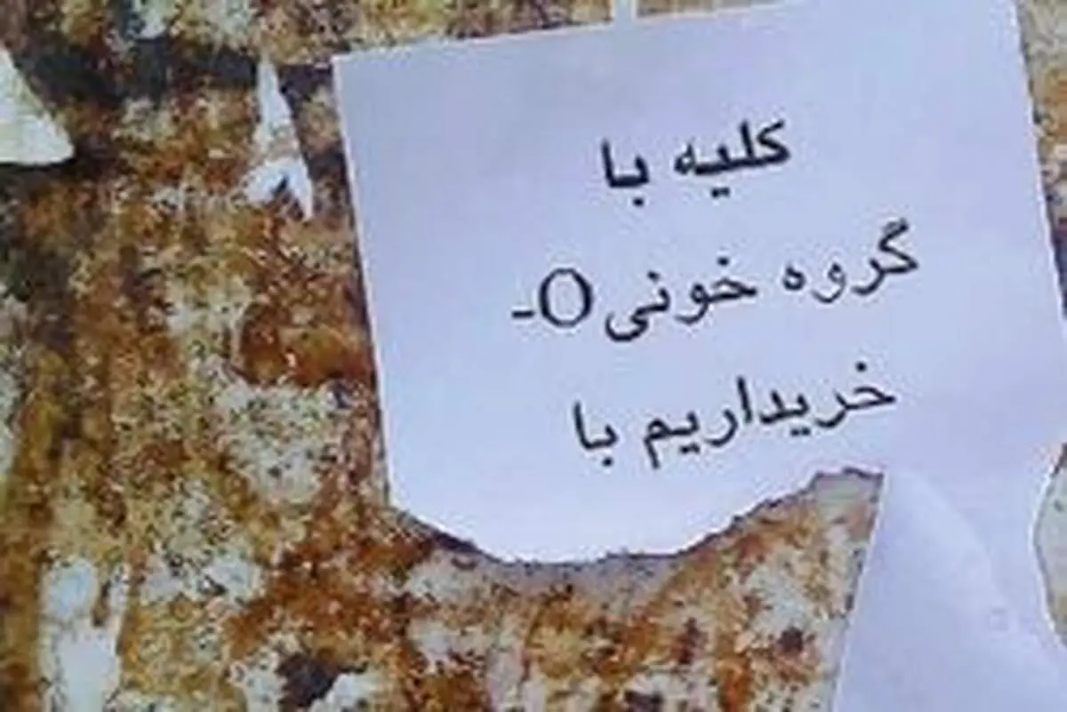 یک تکه کبد، ۱۵۰میلیون تومان!