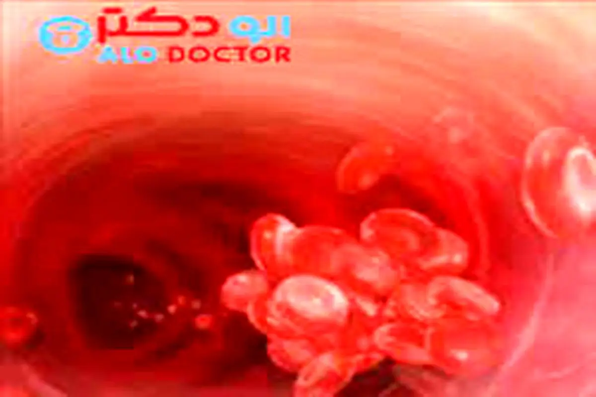 شش علت دفع لخته خون در دوره عادت ماهانه