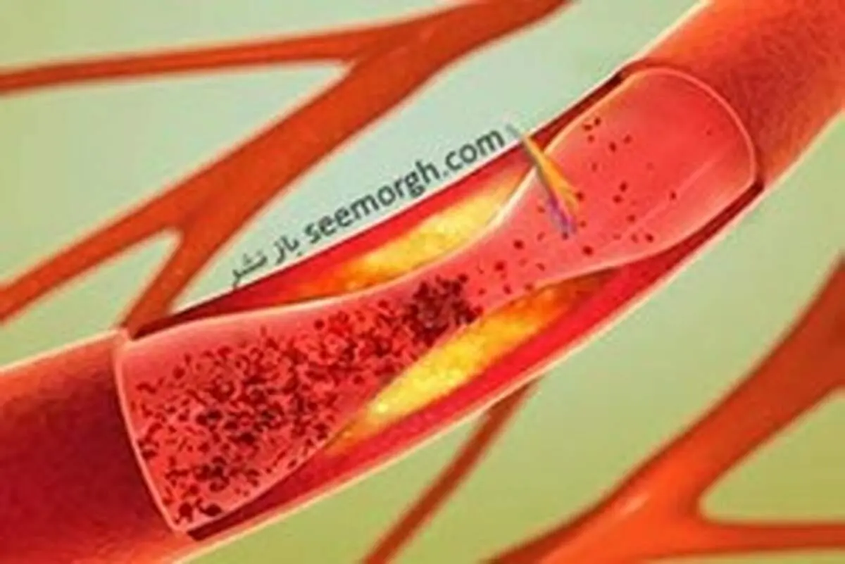 بهترین روش برای تضمین سلامت قلب و عروق