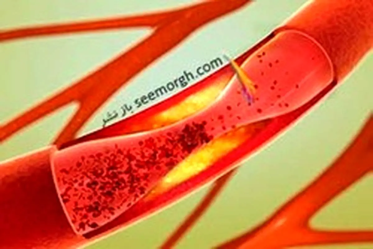 بهترین روش برای تضمین سلامت قلب و عروق