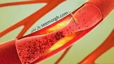 بهترین روش برای تضمین سلامت قلب و عروق