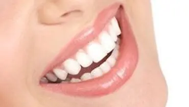 با رعایت این نکات دندان‌های سفیدتری داشته باشید