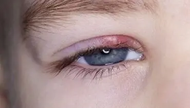 گل مژه و هر آنچه باید بدانید