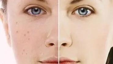 نسخه شگفت انگیز زنان ژاپنی برای زیبایی پوست