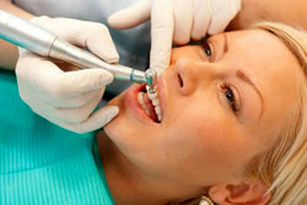 بروساژ دندان چیست و چه کاری برای زیباکردن دندانها انجام میدهد؟