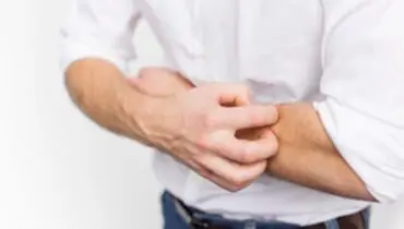 برای رفع خارش پوست چه کنیم؟