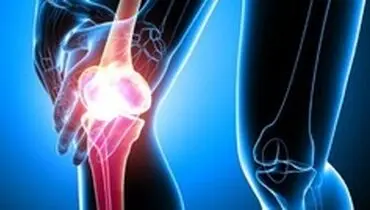 روماتیسم عامل ابتلا به آرتروز
