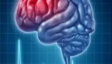 قلب چگونه موجب سکته مغزی می شود؟