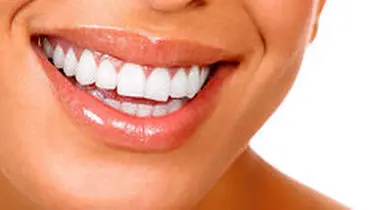 راز خانم‌هایی که همیشه دندان هایشان سفید و زیباست