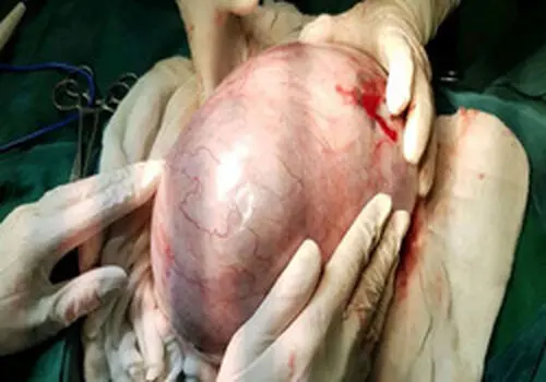 انجام عمل قلب باز به صورت تلفنی!+فیلم