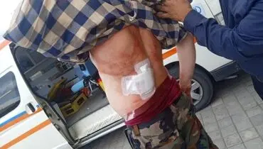 حمله با سلاح سرد به جنگلبان رودباری+ تصاویر