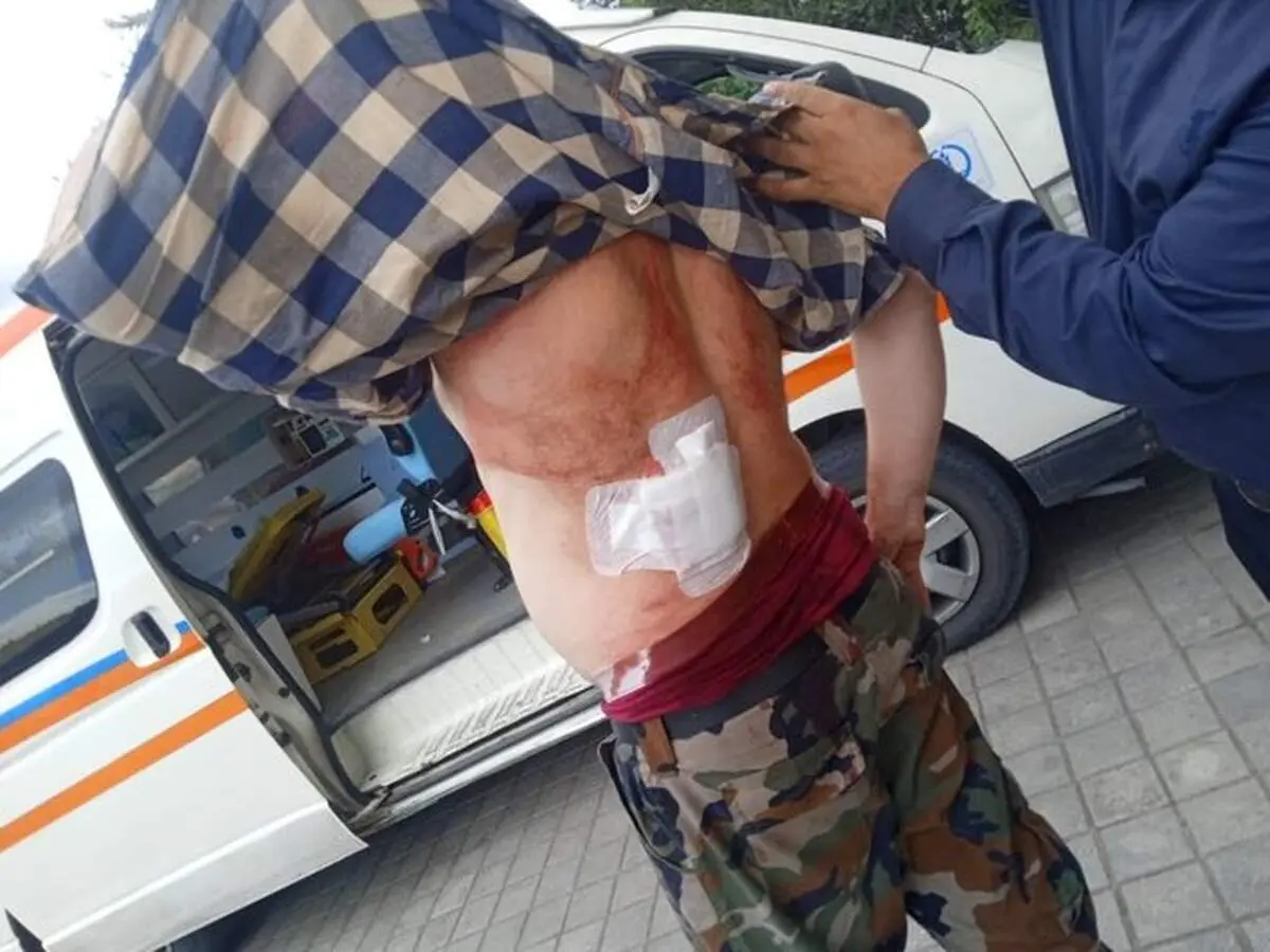 حمله با سلاح سرد به جنگلبان رودباری+ تصاویر