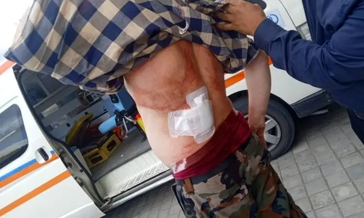 حمله با سلاح سرد به جنگلبان رودباری+ تصاویر