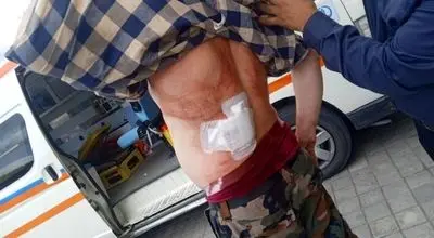 حمله با سلاح سرد به جنگلبان رودباری+ تصاویر