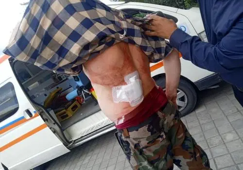 حمله با سلاح سرد به جنگلبان رودباری+ تصاویر