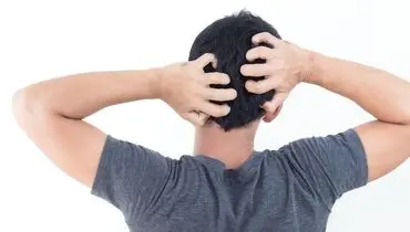رابطه خارش پوست سر و ریزش مو
