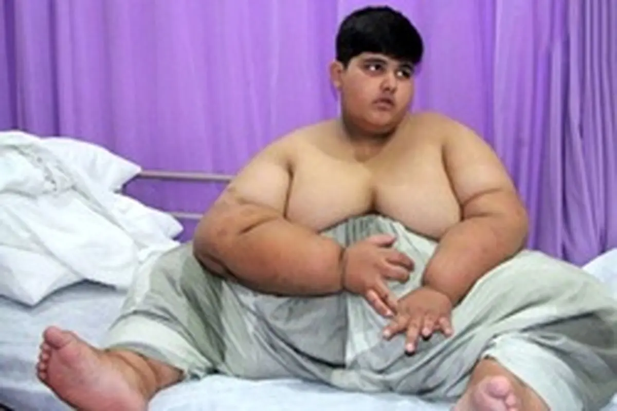 محمد ۱۰ ساله چاق‌ترین کودک جهان