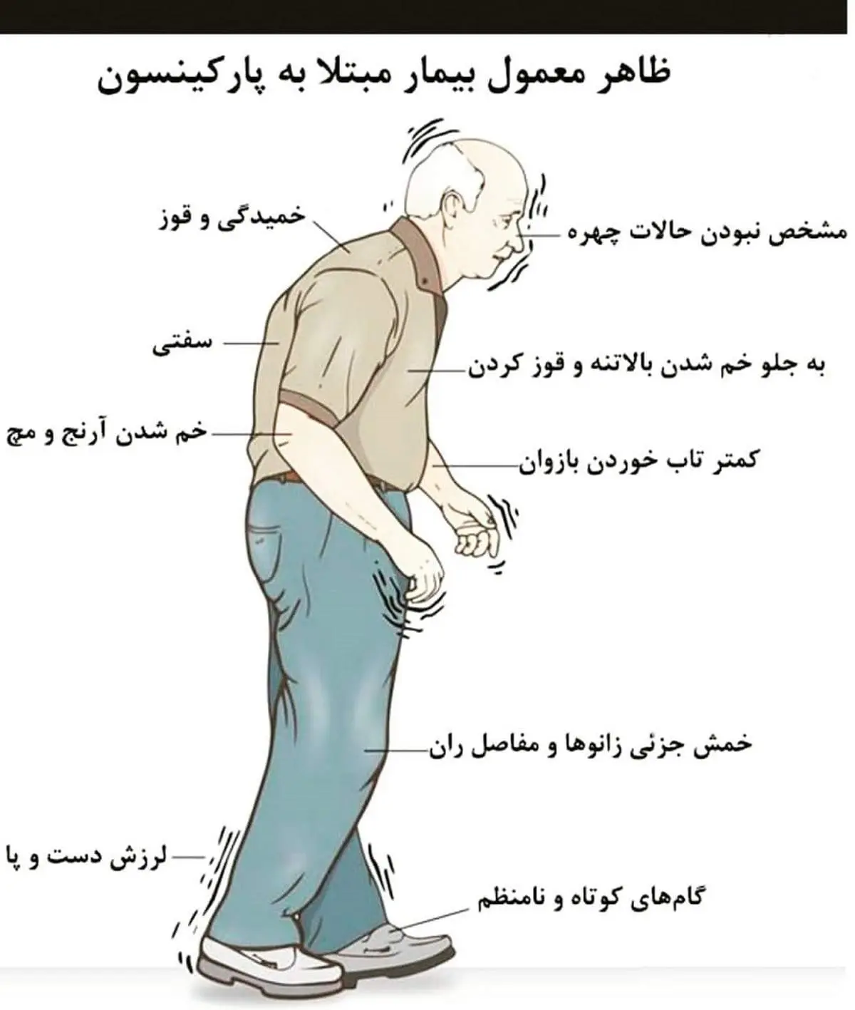 چه کسانی در معرض پارکینسون هستند؟ + اینفوگرافیک