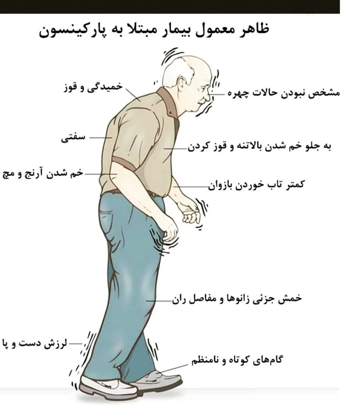 چه کسانی در معرض پارکینسون هستند؟ + اینفوگرافیک