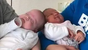 تولد دوقلو‌های متفاوت با ۳ ماه اختلاف سنی!