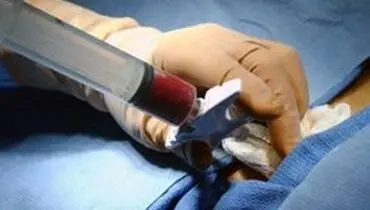 انجام موفقیت آمیز اولین پیوند مغز استخوان در بیمار مبتلا به HIV