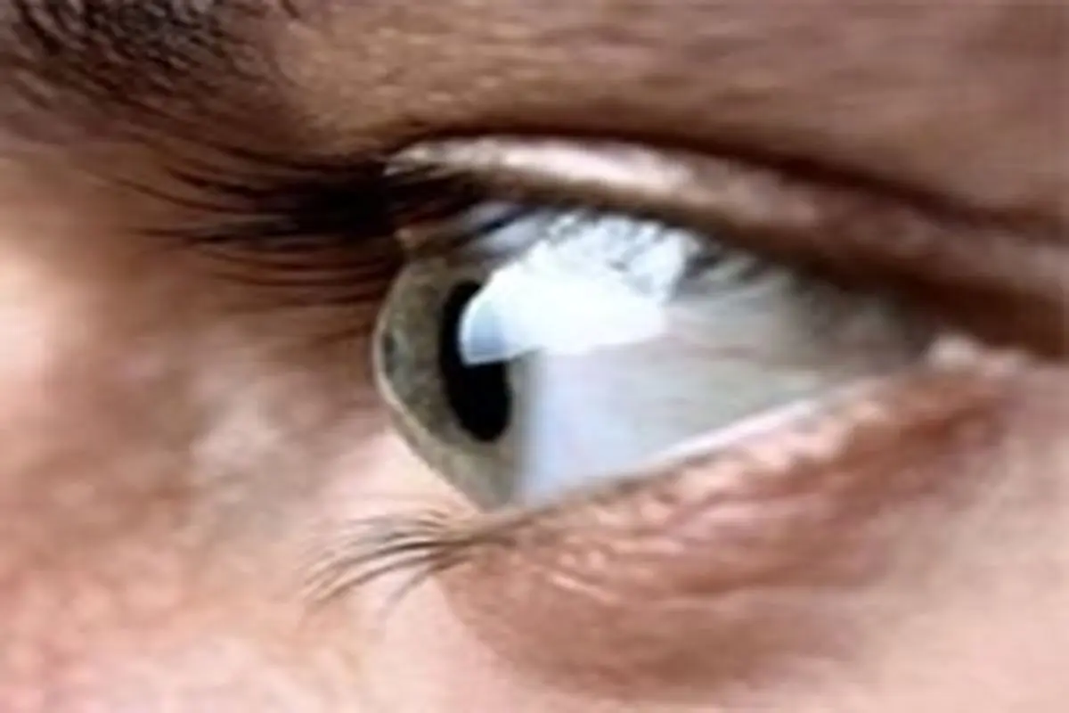 ۸ درمان طبیعی خشکی چشم