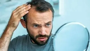 ۸ درمان طبیعی برای مقابله با نازکی مو